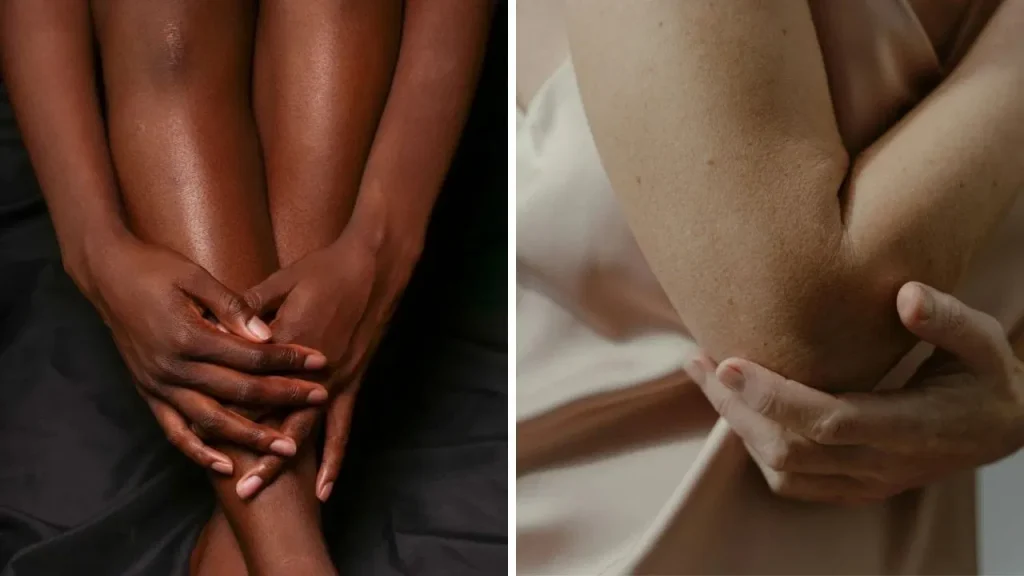 get-rid-of-dark-knees-elbows-natural-pigmentation-hacks