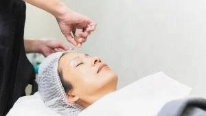 collagen-thread-treatment
