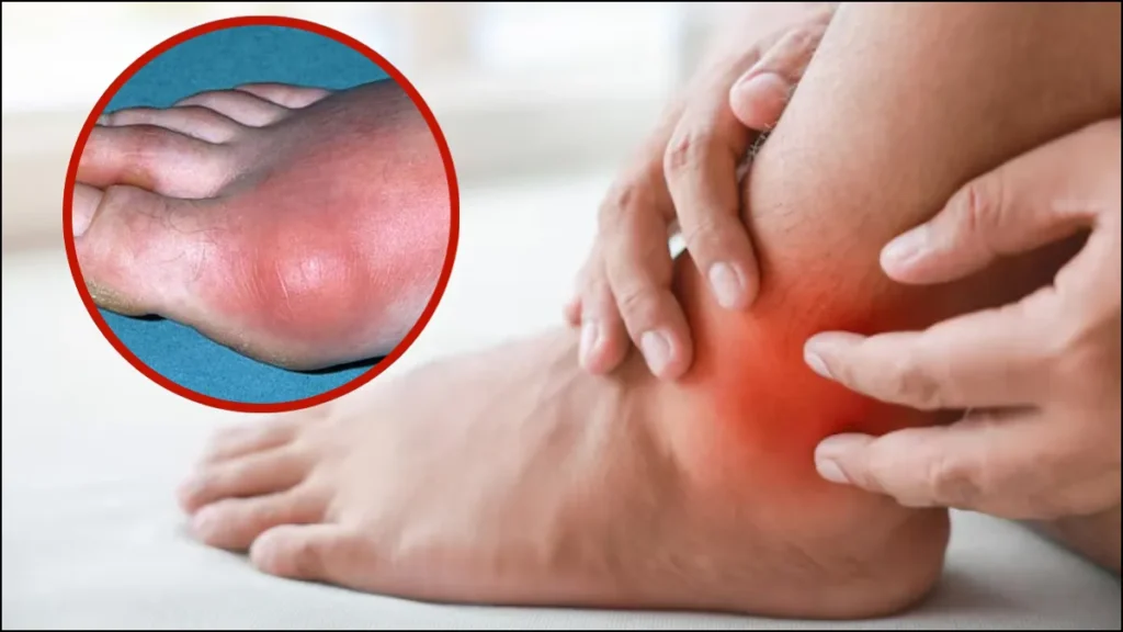 high-uric-acid-symptoms-17-06-2025-1750133269