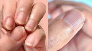 lines-on-nails-11-06-2025-1749606369