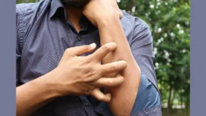 skin-infection-