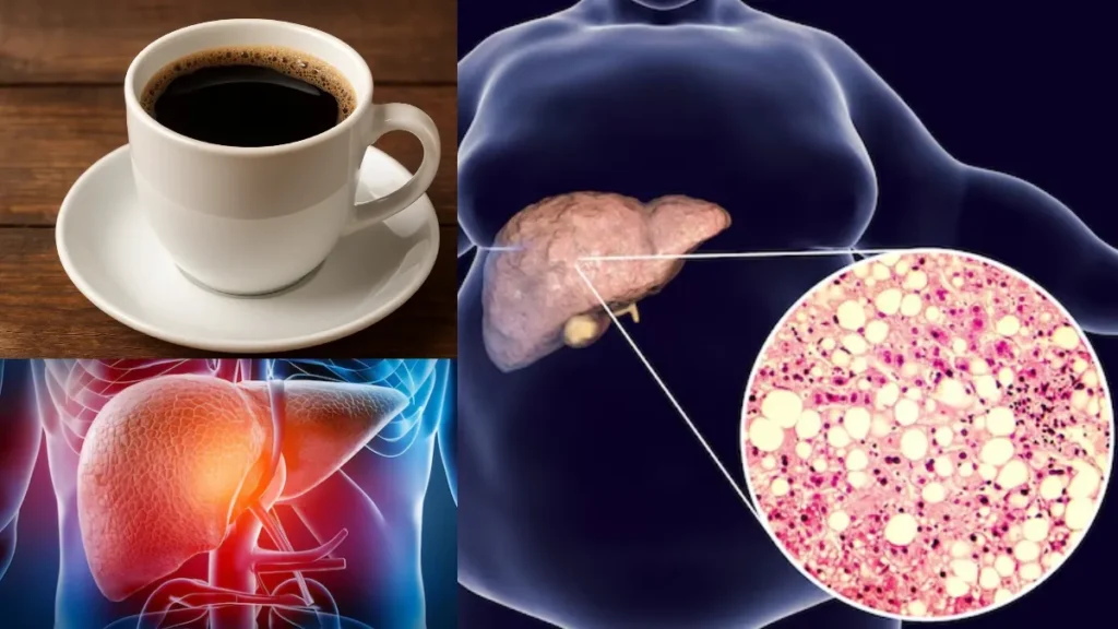 coffee-for-liver-10-07-2025-1752061703