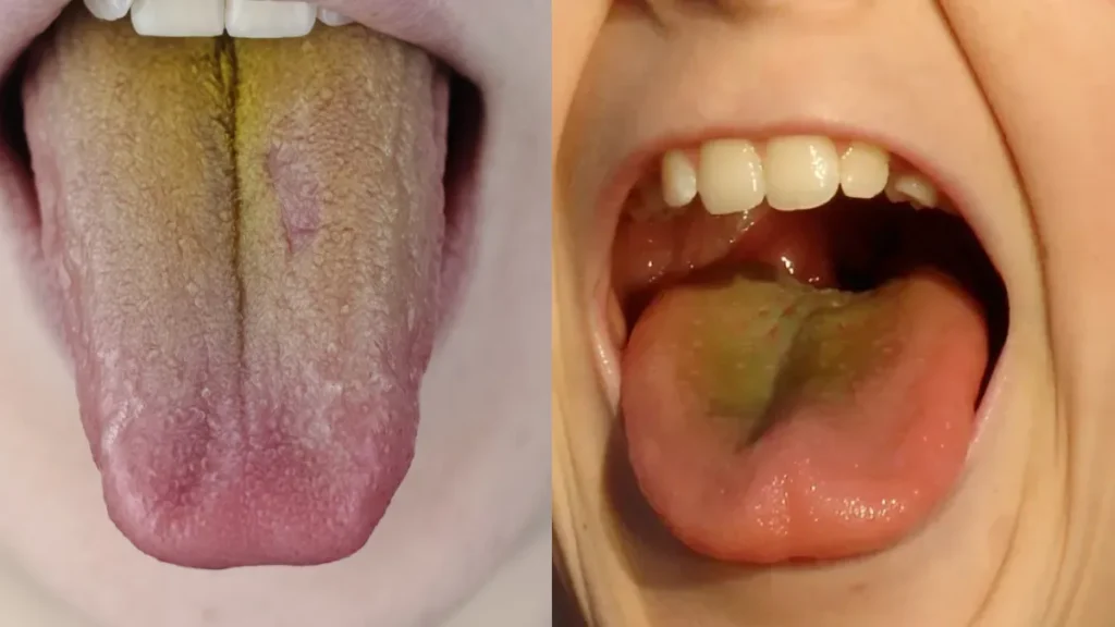 tongue-color-change-18-07-2025-1752805093