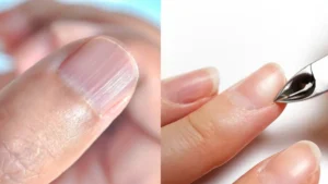 lines-on-nails-21-08-2025-1755683133