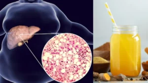 fatty-liver-drink-03-09-2025-1756866480