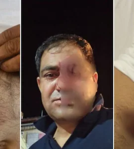 l8cg1ptk_police-attacked-in-jodhpur_625x300_18_September_25
