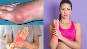 uric-acid-home-remedy-09-09-2025-1757400776