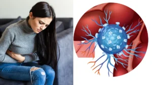 viral-gastroenteritis-02-09-2025-1756779319
