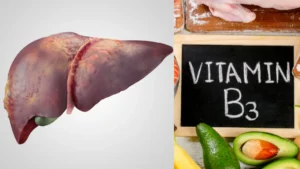 vitamin-b3-in-fatty-liver-18-09-2025-1758171762