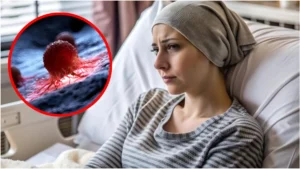 cancer-minor-symptoms-12-10-2025-1760253307