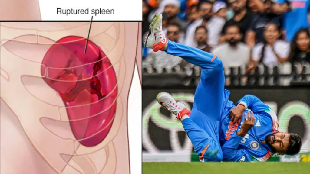 shreyas-iyer-injury-28-10-2025-1761642975
